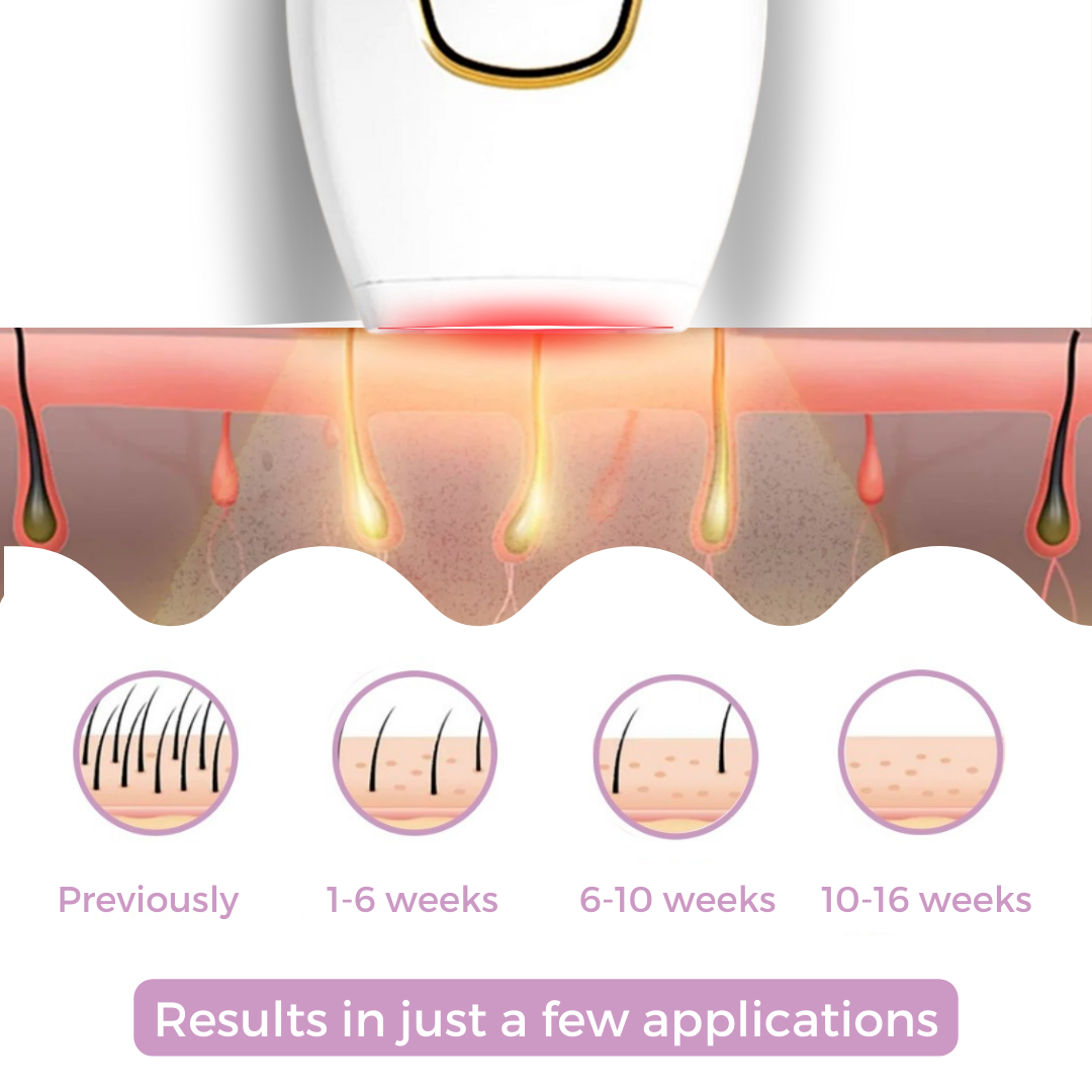 IPL Hair Remover™ - Pain-Free Path to Smooth Skin